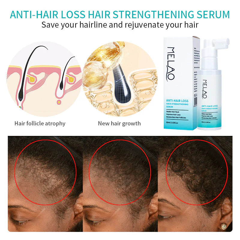 Hair Growth Serum Scalp Treatment Strengthening